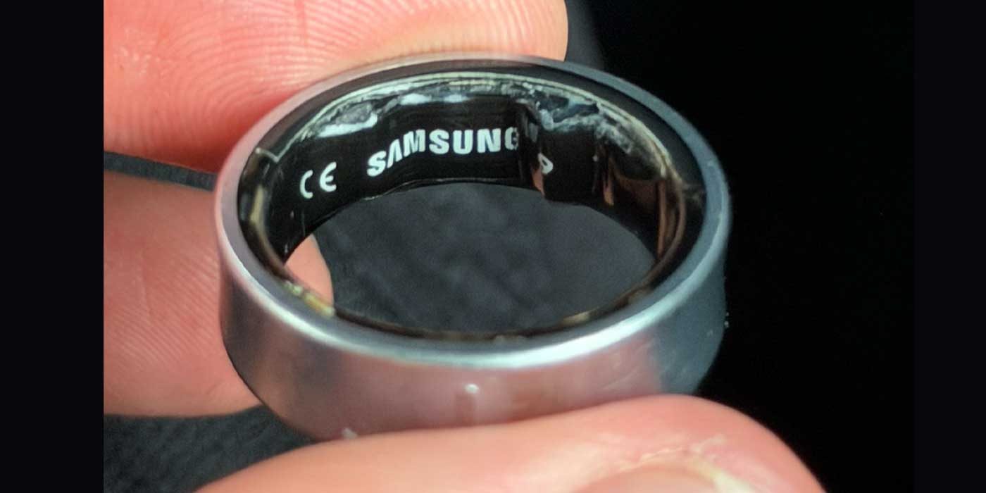 Раздувшийся аккумулятор Galaxy Ring застрял на пальце и привел к визиту в больницу [Галерея]